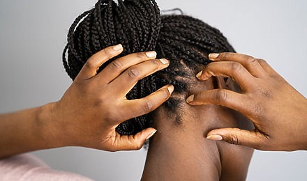 Why Is My Scalp Tender In One Spot