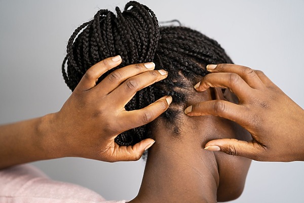 why is my scalp tender in one spot