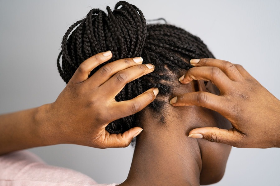 Why Is My Scalp Tender In One Spot
