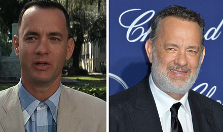 Tom Hanks&rsquo; Hair Transplant: Everything You Need To Know