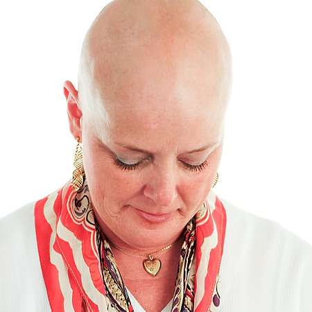 chemotherapy hair loss edited
