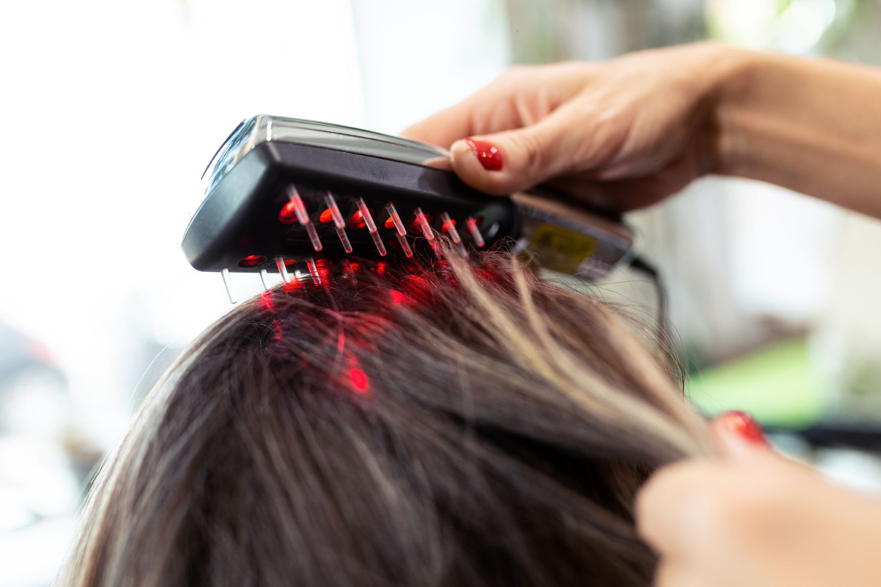 Low-Level Laser Therapy (LLLT)