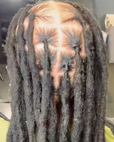 Balding men with dreadlocks