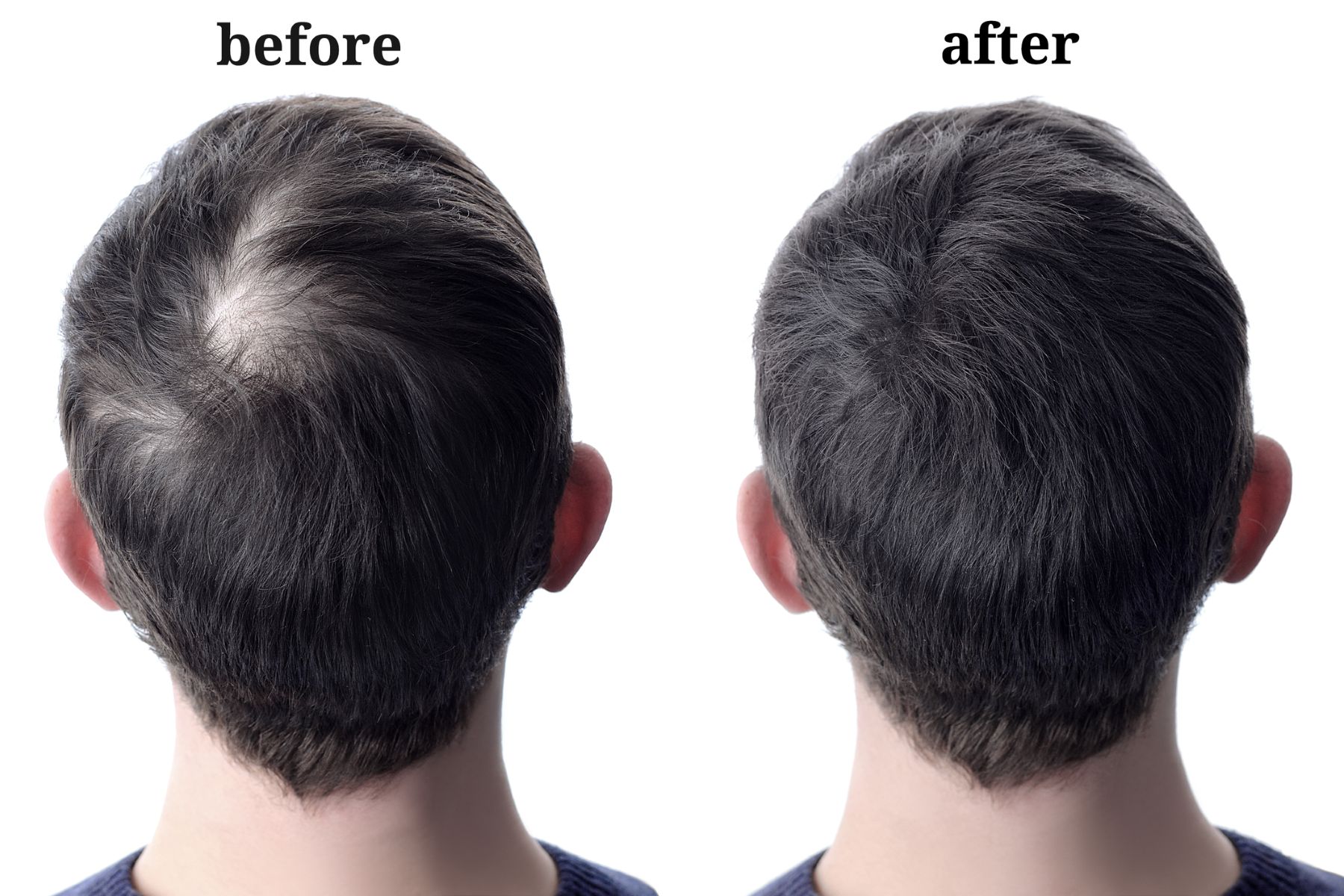 Before and after hair thickening powder