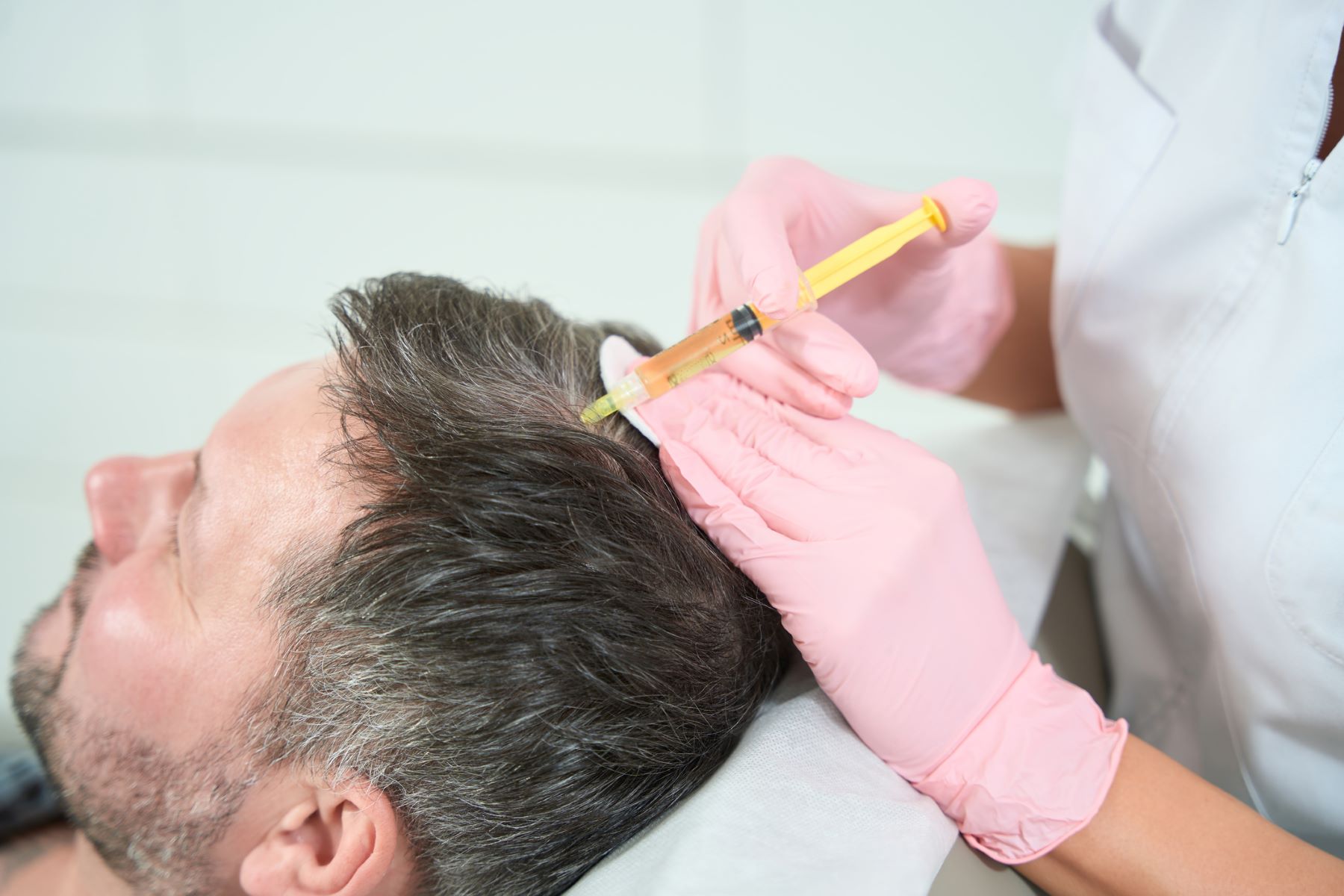 Man getting PRP after hair transplant
