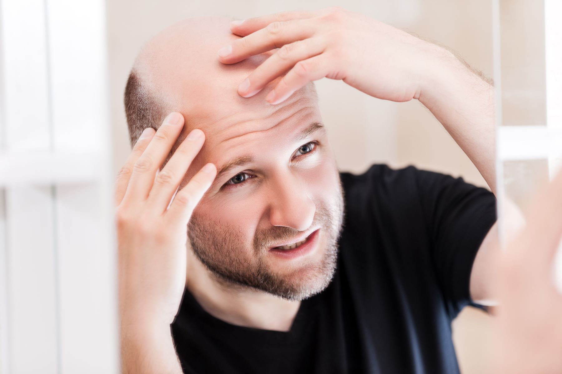Man with a balding crown