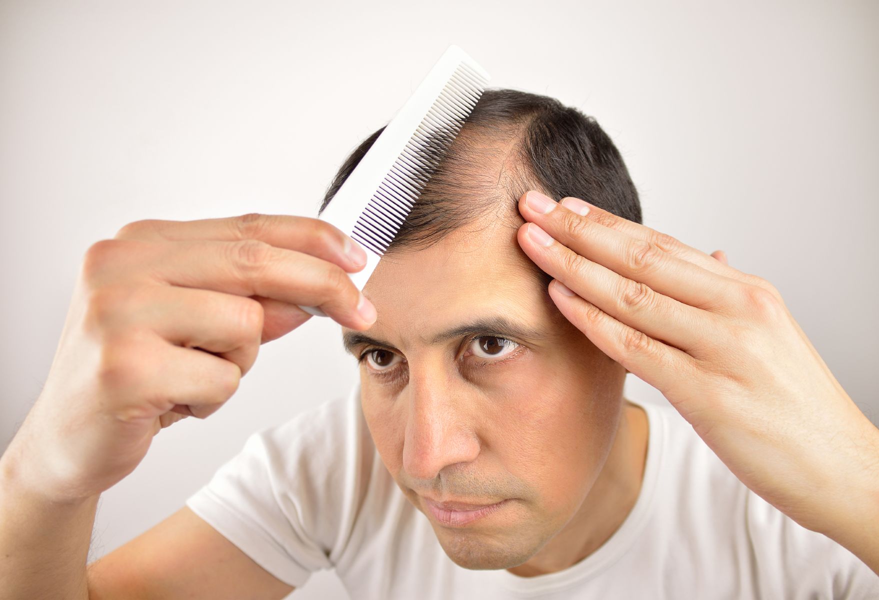 See through combover for balding men