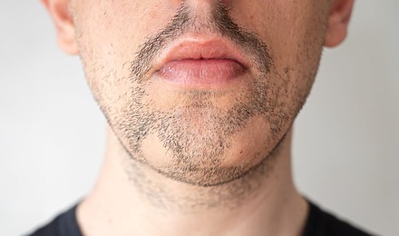 7 Common Causes For Patchy Beard Growth