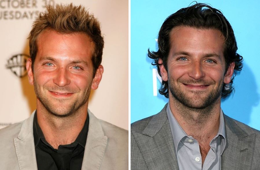 Bradley Cooper’s hairline changed between 2007 and 2008