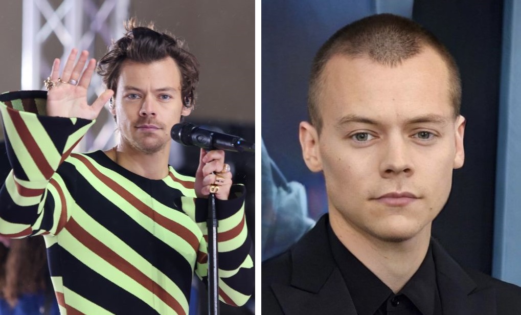 Is Harry Styles Balding? The Scoop on Harry&rsquo;s Hair Journey