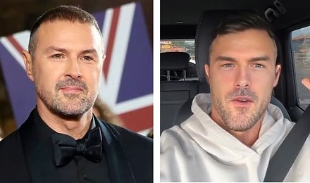 Paddy McGuiness&rsquo;s Hair Transplant: Was Paddy Just Kidding?