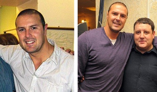 Paddy McGuinness&rsquo;s first signs of balding