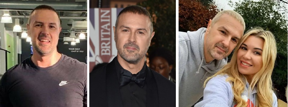 Paddy McGuinness&rsquo;s rumoured hair transplant