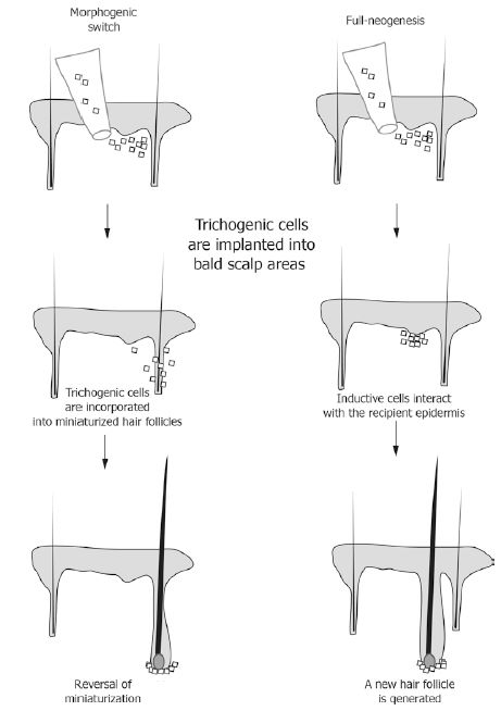 Using hair cloning to restore hair follicles or grow new ones