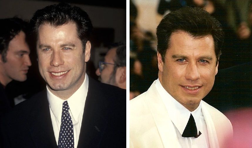 Travolta&rsquo;s first signs of hair loss