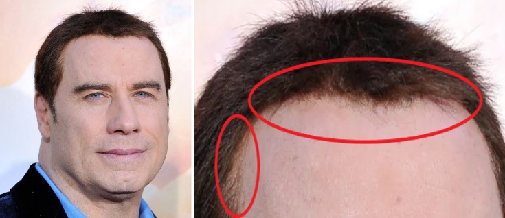Travolta&rsquo;s toupee edges visible in photo