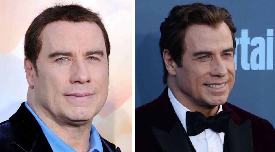 Travolta&rsquo;s wig-wearing years