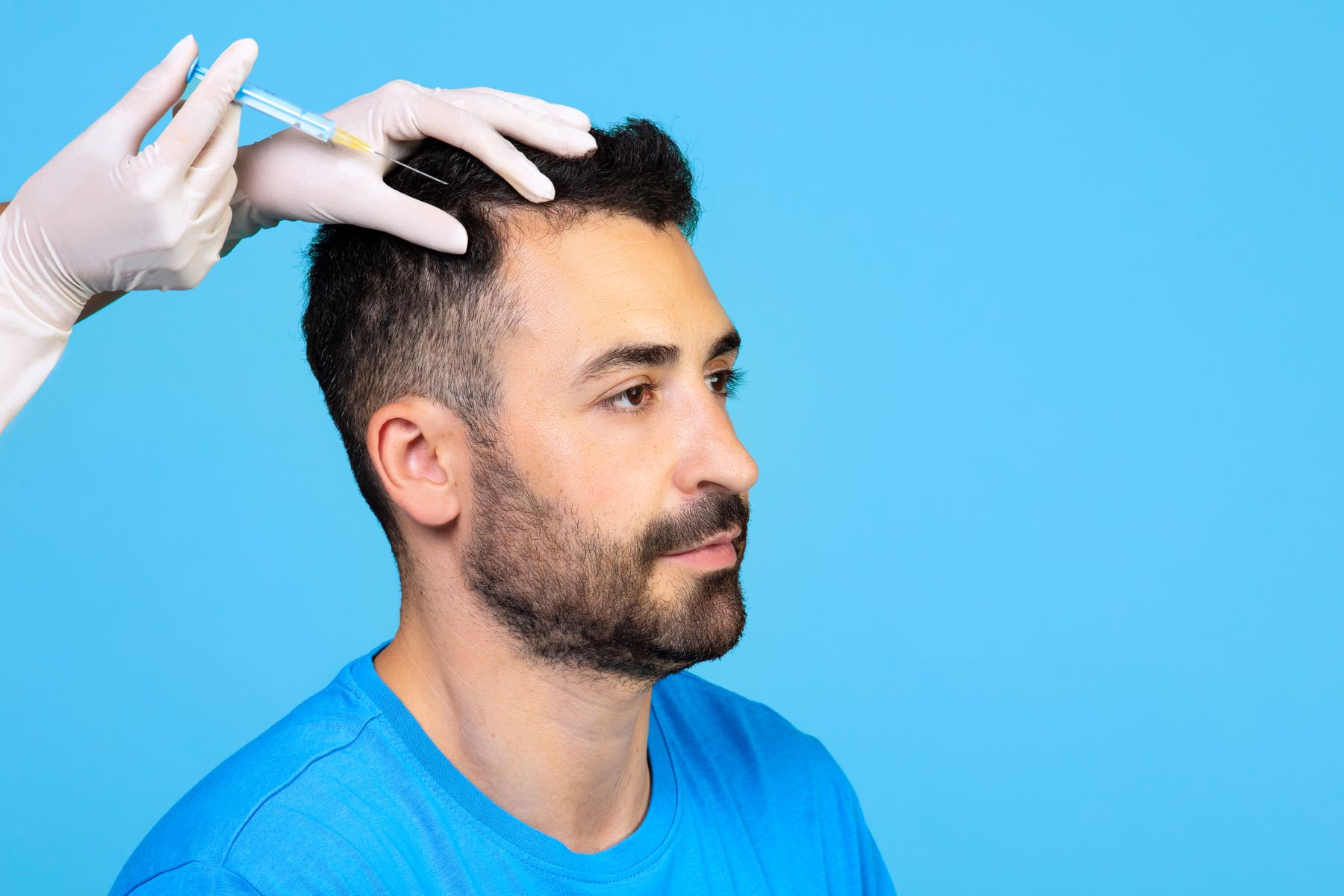 PRP hair treatment
