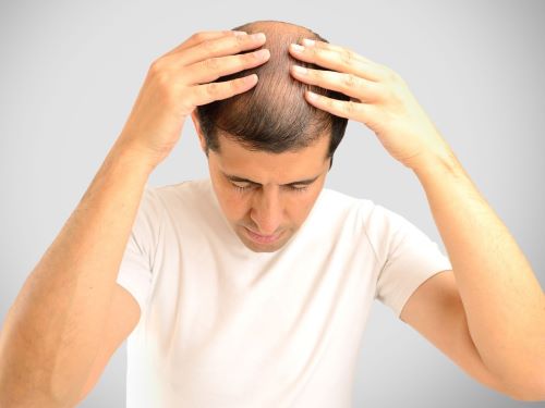 combover