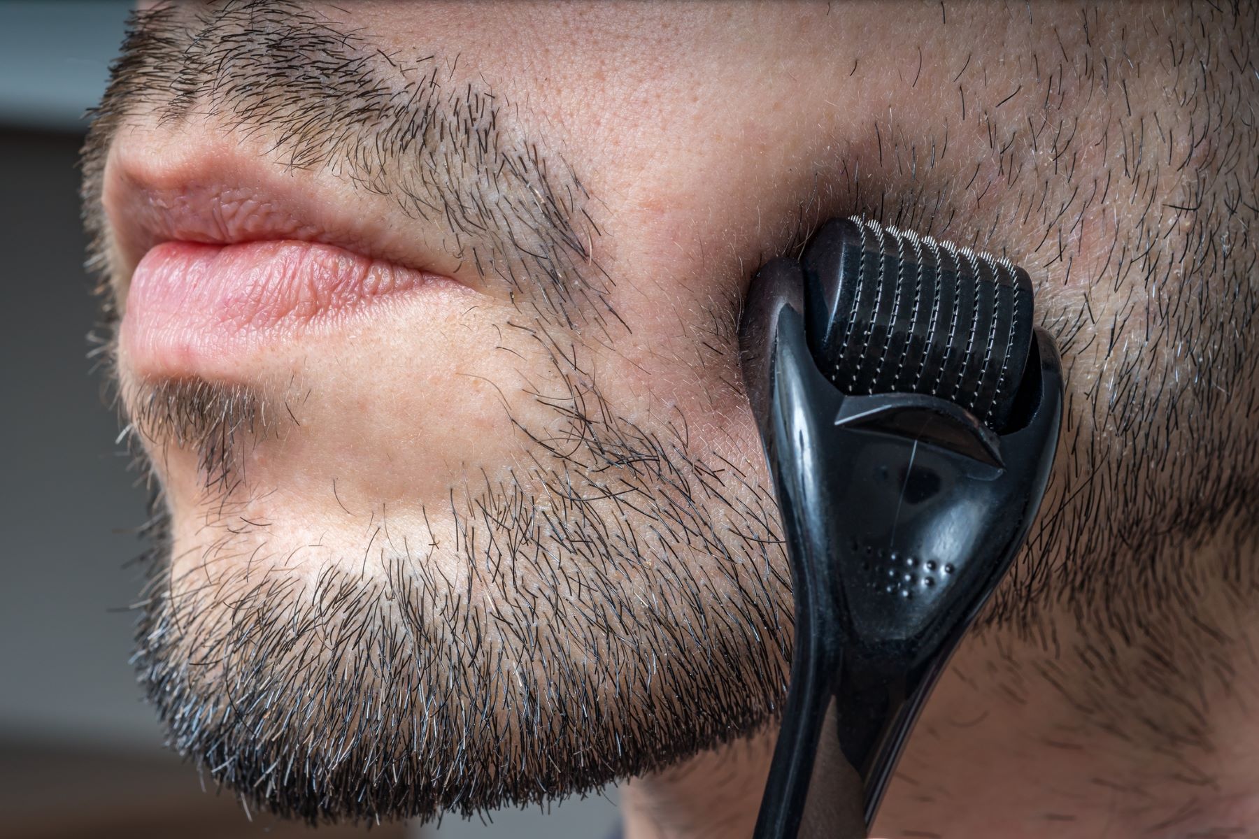 Derma roller for beard growth