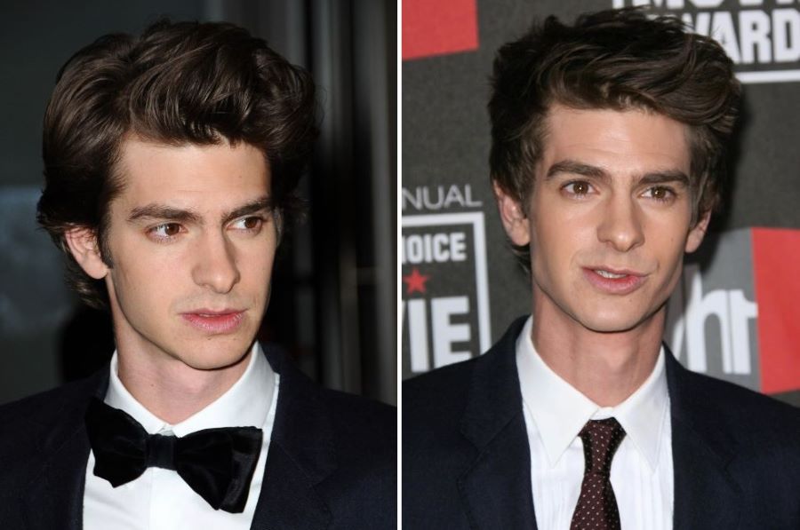 Andrew Garfield’s hairline 2010-2011
