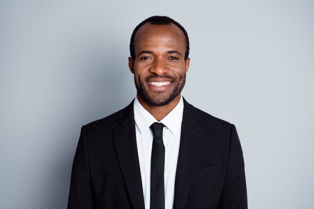 receding hairline Black men