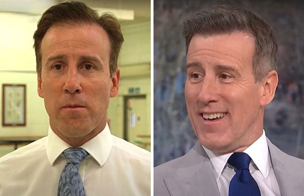 Anton Du Beke hair transplant