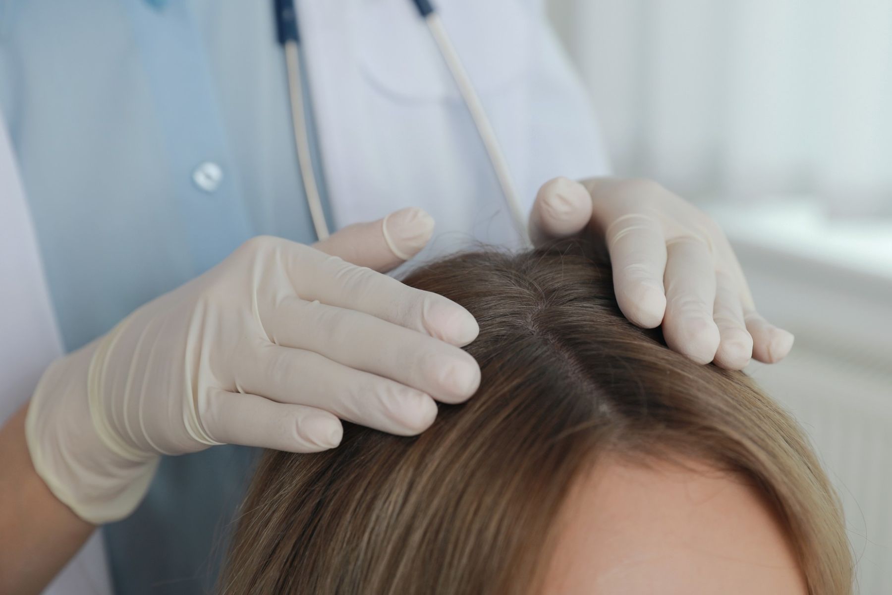 Expert help for hair loss