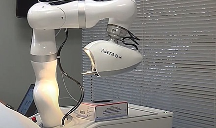 Is A Robotic Hair Transplant Better Than A Manual One?