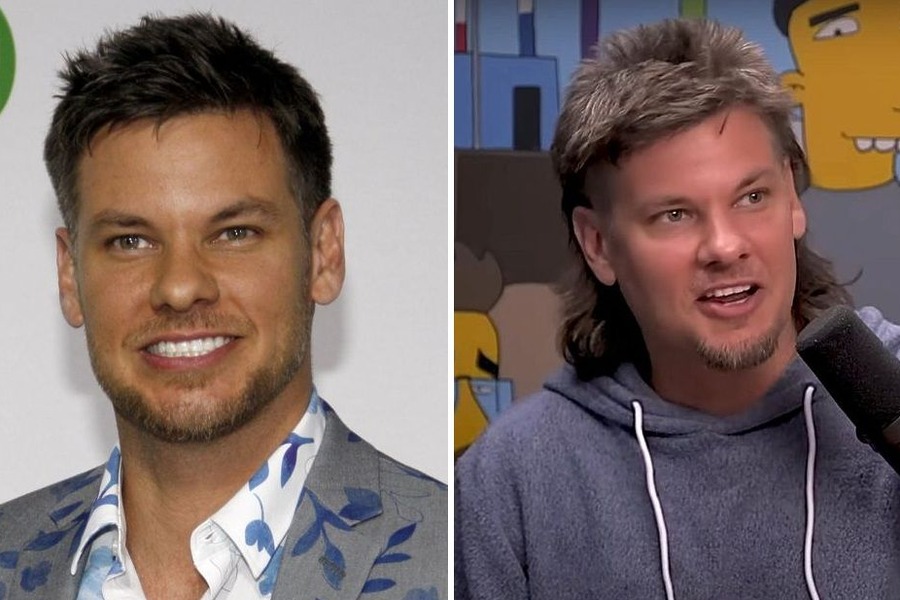 Theo Von Hair Transplant