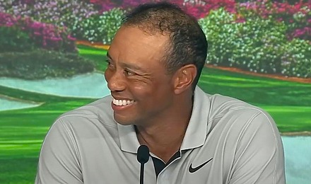 Tiger Woods Hair Transplant