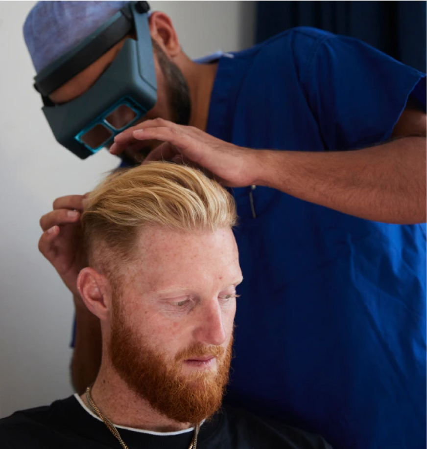 Wimpole Derby hair transplant treatment