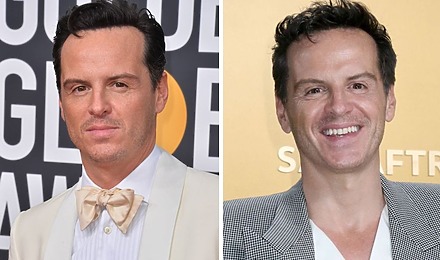 Andrew Scott’s Hair Transplant - Did It Really Happen
