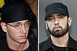 Beard Transplant