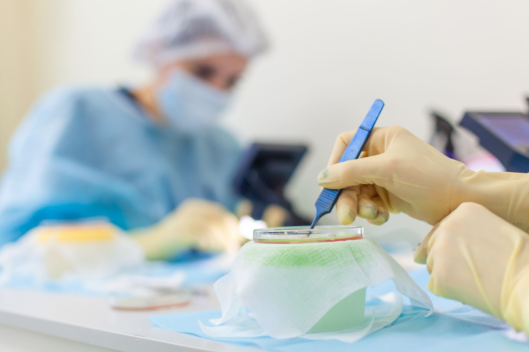 Hair graft preparation in Turkey