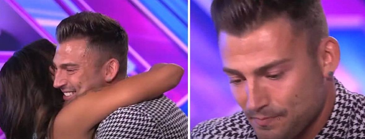 Jake Quickenden’s temple hair loss and m-shaped hairline