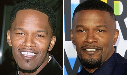 Jamie Foxx Hair Transplant