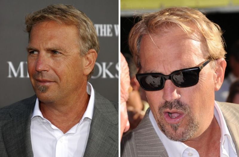 Kevin Costner after his hair transplant