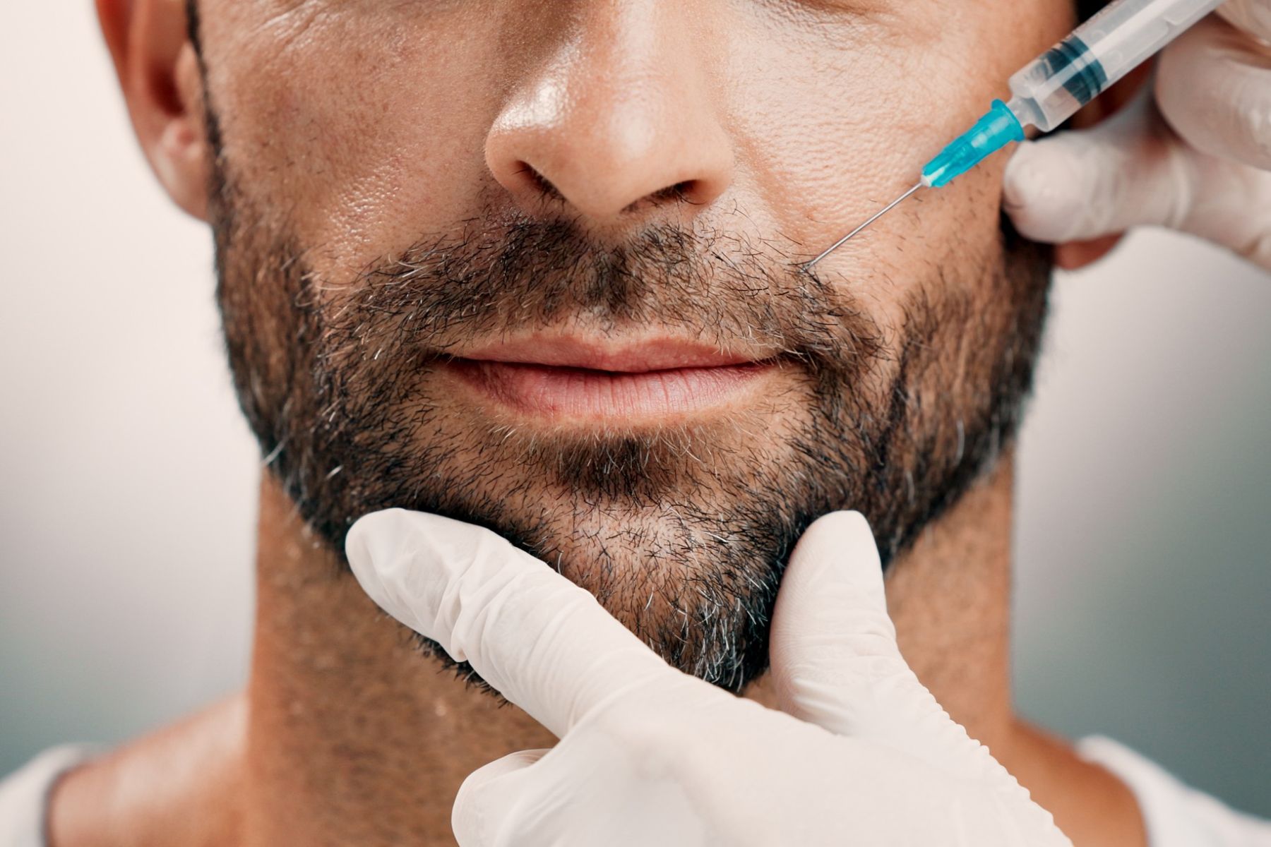 PRP hair treatment for beard