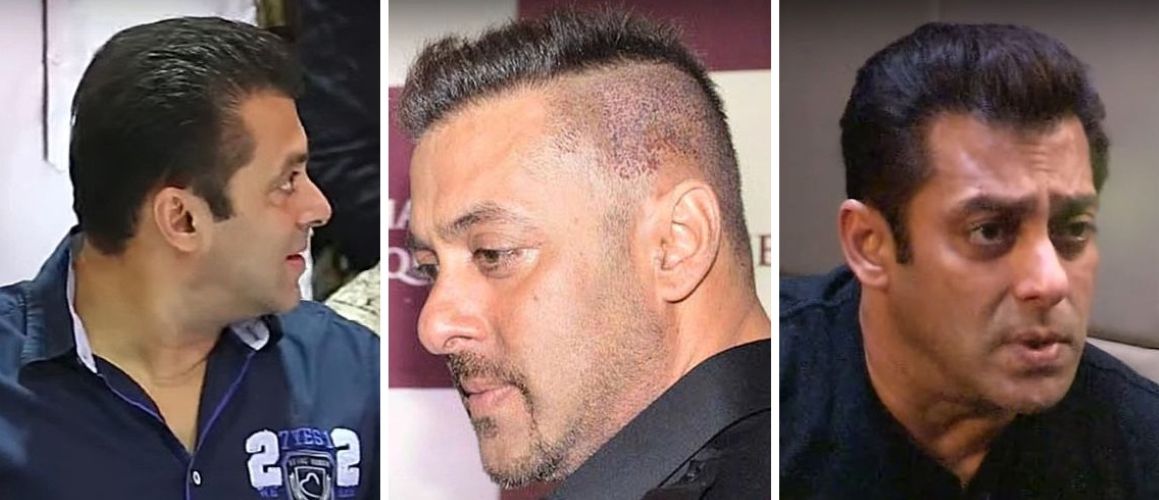 Salman Khan before and after third hair transplant