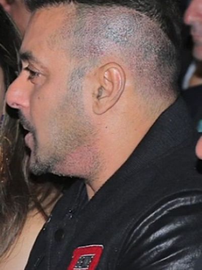 Salman Khan post-hair transplant