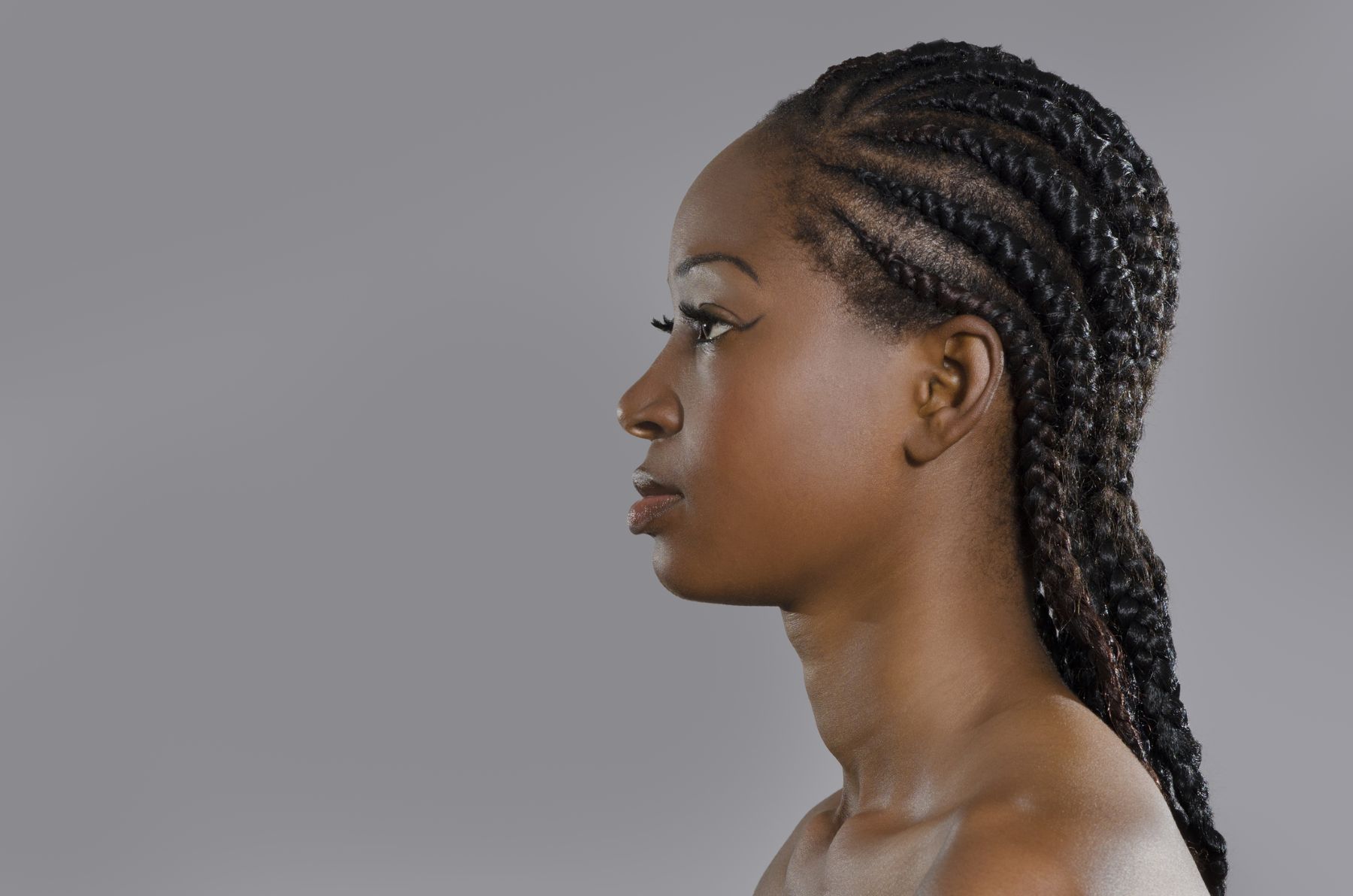 tight hairstyles cause traction alopecia