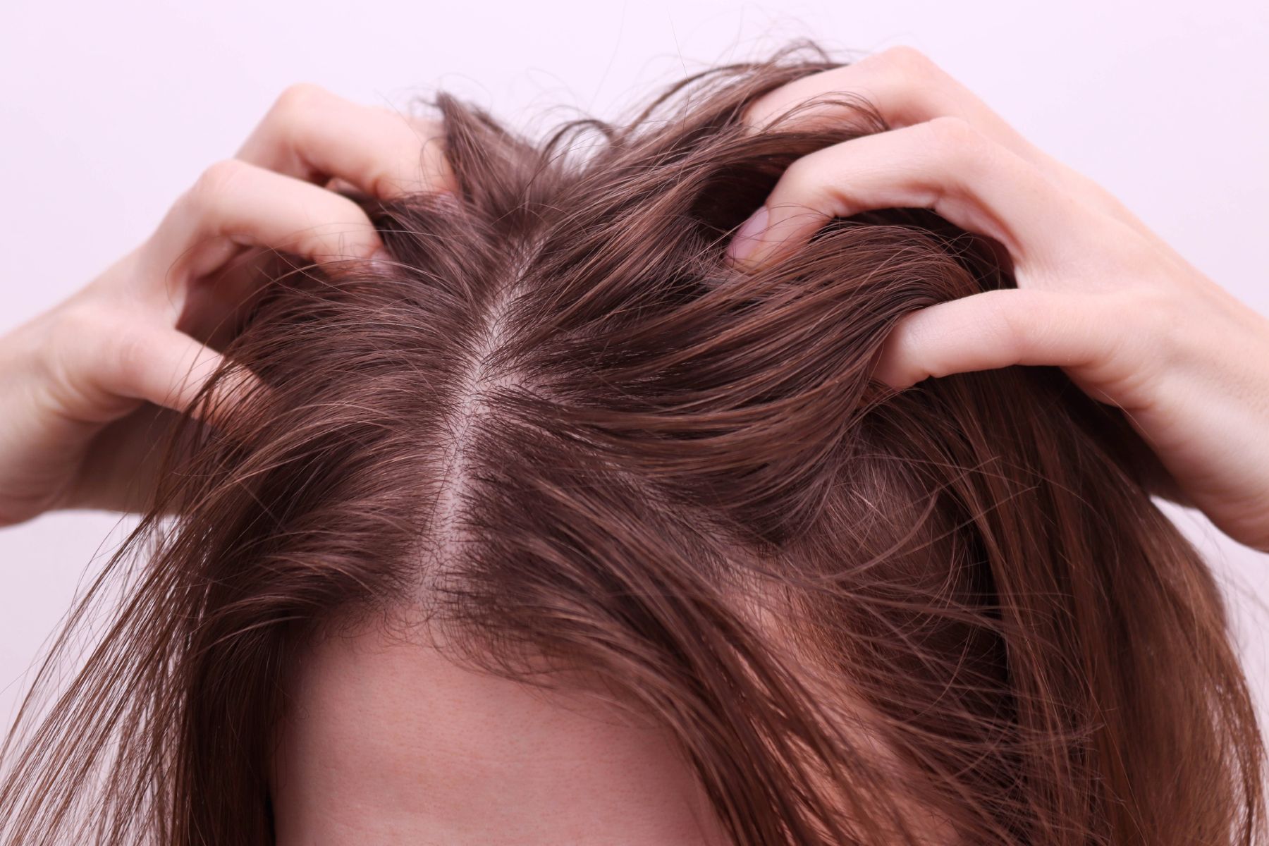 woman with hair and scalp problems