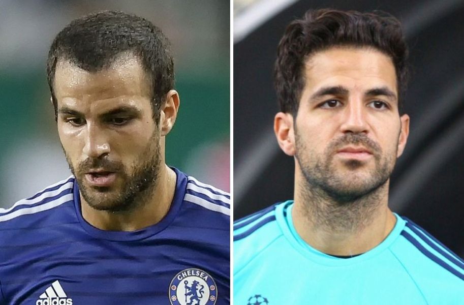Cesc Fàbregas hair transplant