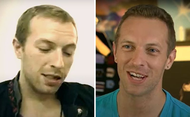 Chris Martin in 2010 and 2011