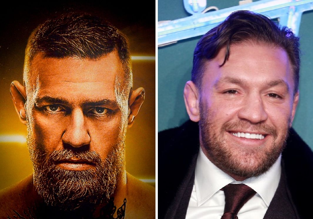 Did Conor McGregor’s Hair Transplant Happen (And Fail)