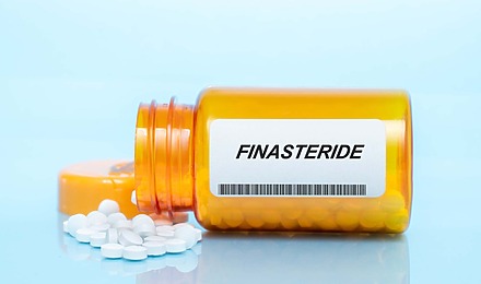 Finasteride NHS
