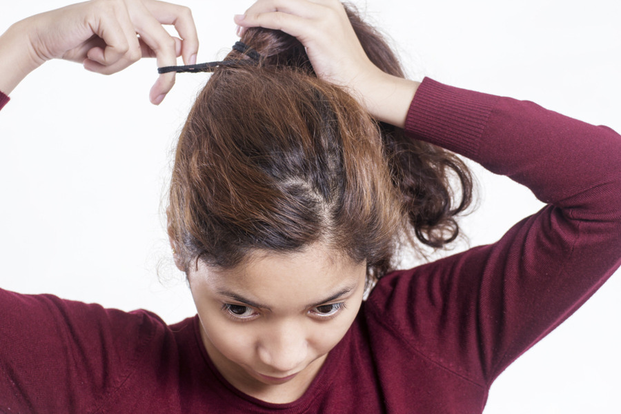 Frizzy Broken Hair On Top Of Head