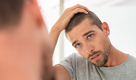 How To Tell If Your Hairline Is Receding