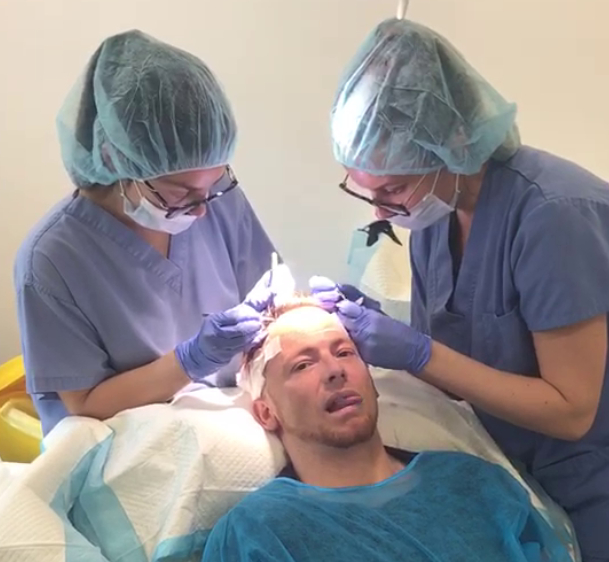 Joe Swash undergoing hair transplantation at a hair transplant clinic